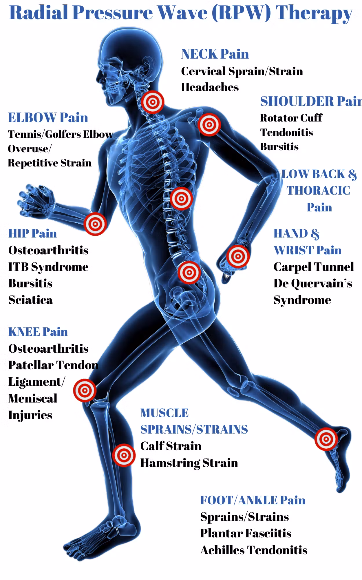 RPW-Shockwave-Body-Parts